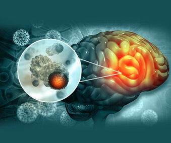 Curso Neuropsicología Pediátrica en Enfermedades Genéticas 4h